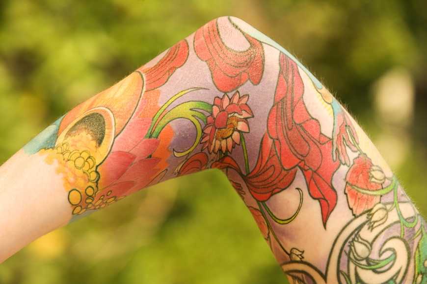 a színes tetoválás is eltávolítható